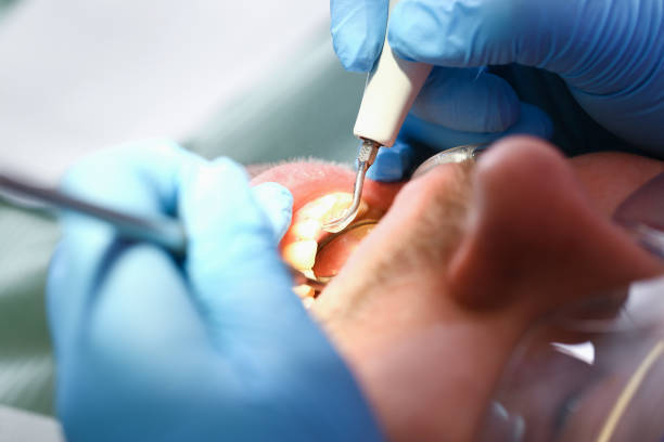 Best Dentist for Tooth Abscess  in Riverside, CT