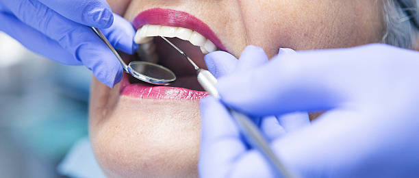 Best Dentist for Tooth Abscess  in Riverside, CT